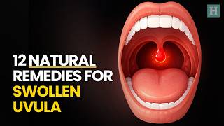 12 Natural Remedies For Swollen Uvula | Healthspectra