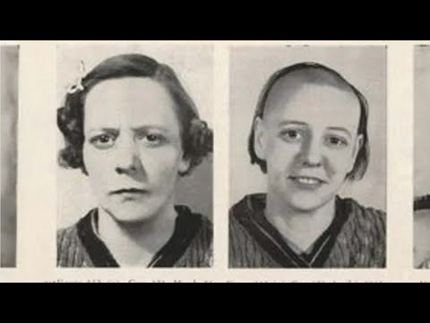 The Insane Lobotomy Craze Of The 1950s