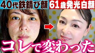 【40歳→60歳】シミに悩んでた私が本当に使用感が良かった３つの美白スキンケア