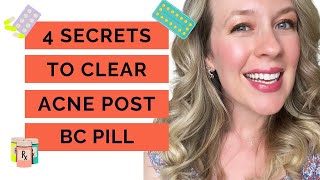 How to cure hormonal acne - WITHOUT BIRTH CONTROL