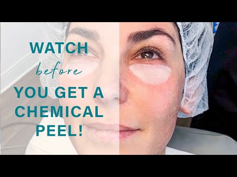 Kosmyq Under Eye Peel