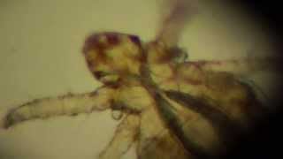 preview picture of video 'Mites Under Microscope: Story about Terrible Grain Itchy Mite Pediculoides ventricosus (ENG)'