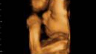 preview picture of video 'Beautiful 27wk 4D baby bonding scan'