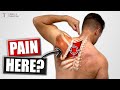3 Fast Fixes For Rhomboid Pain Relief! [Fix Your Upper Back Pain!]