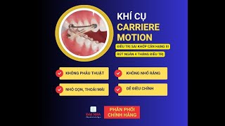 Khí cụ carriere motion sử dụng trong điều trị sai khớp cắn hạng II III