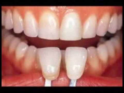 Yılmaz Dental Laboratory