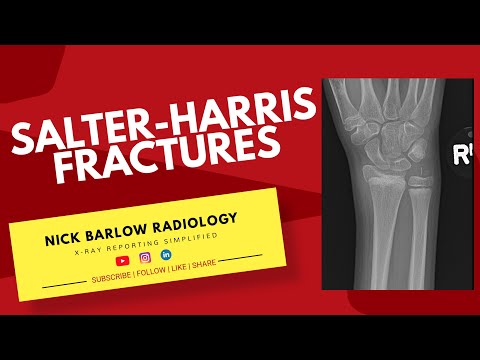 Salter-Harris Classification