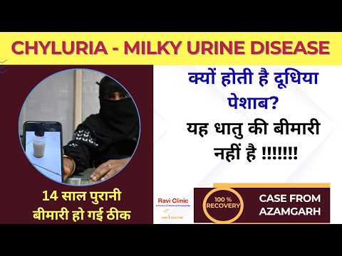 From 2010 to Total Recovery: Curing Chyluria with Homoeopathy 2 Year Follow up