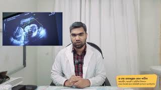 Dr. Galib - ফ্রোজেন শোল্ডার