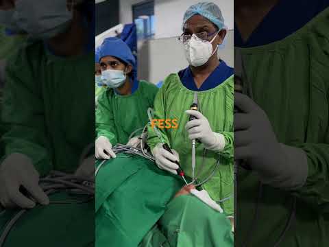 FESS by Dr. SB Etulgama ENT surgeon.👨‍⚕️ #hospital #sinusitistreatment 👌