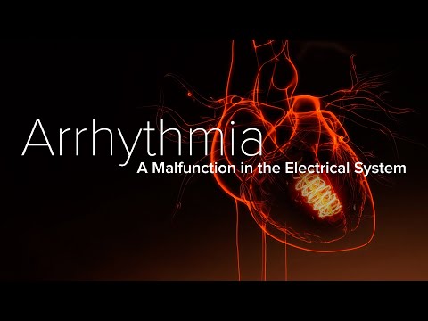 Heart Arrhythmia – Yale Medicine Explains