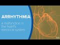 Why a Consistent Heart Rhythm is Important – Yale Medicine Explains