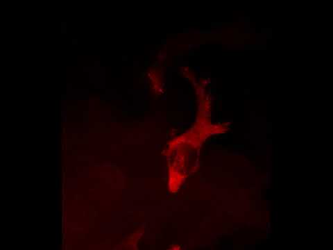 MAX10 31 zmel cttntagRFPT in kdrlGFP 1dpi Airyscan Processingcropped cttn only