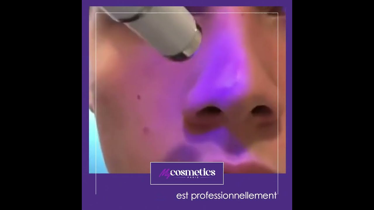STYLO LASER ANTI-TÂCHES
