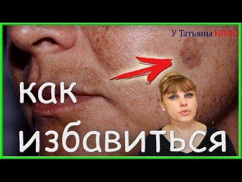 Где купить отбеливающий крем зеленый чай Календулы от веснушек