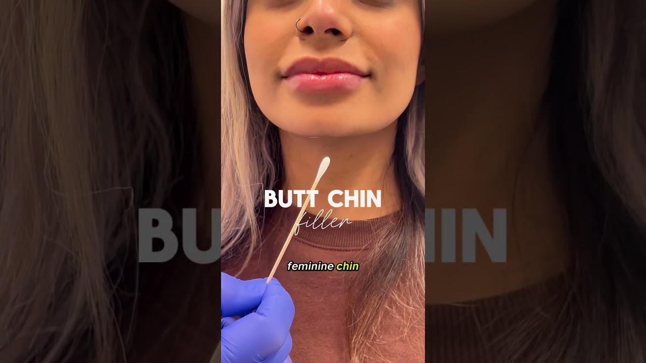 How to get rid of a butt chin