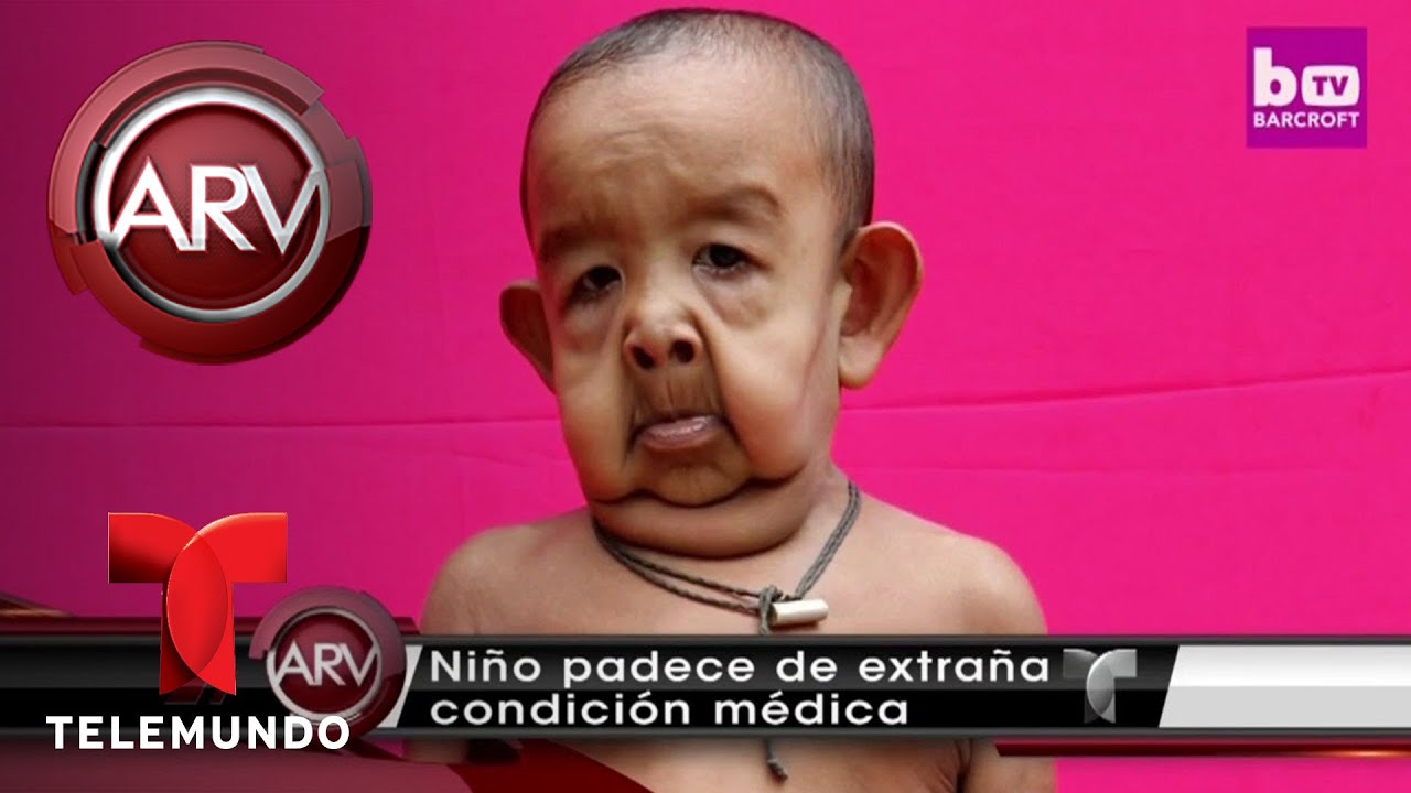 Watch El bebé anciano de Bangladesh, un niño querido | Al Rojo Vivo | Telemundo Now El bebé anciano de Bangladesh, un niño querido | Al Rojo Vivo | Telemundo