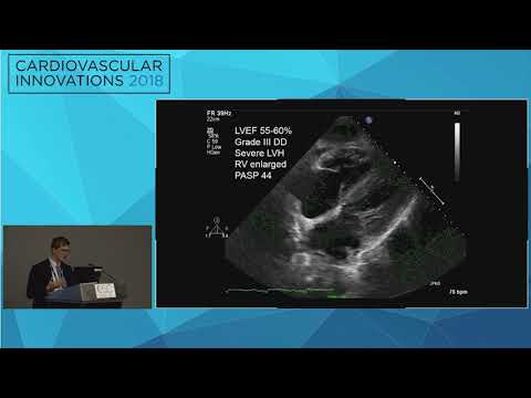 CVI2018 Session: If you hear hoofbeats, think of horses, but remember deadly zebras