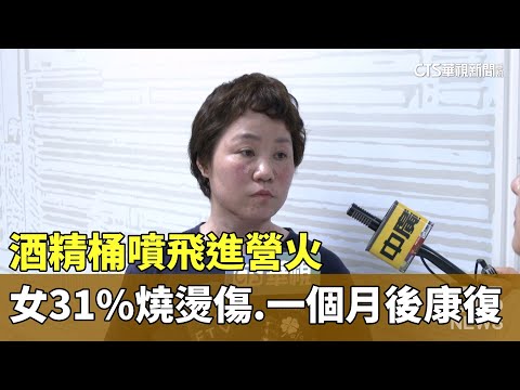 酒精桶噴飛進營火　女31%燒燙傷.一個月後康復