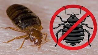 How To KILL Bed Bugs Get Rid of Bed Bugs Fast and Easily naturally
