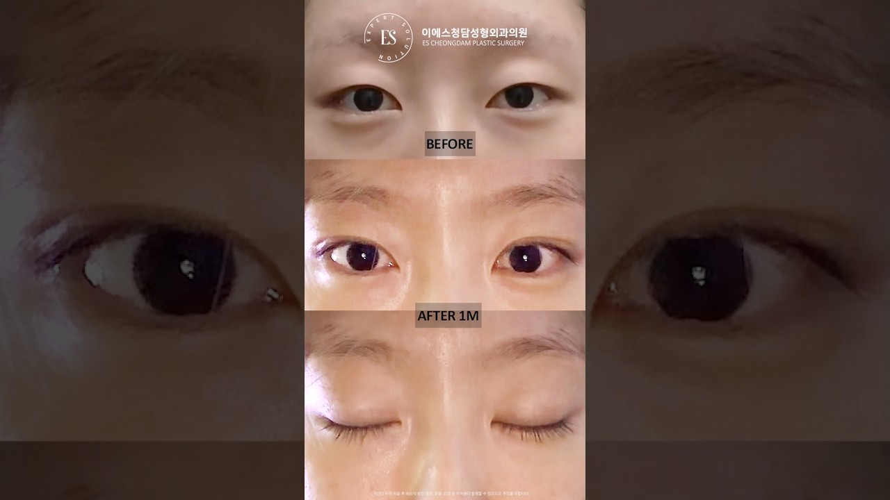 이에스 유튜브