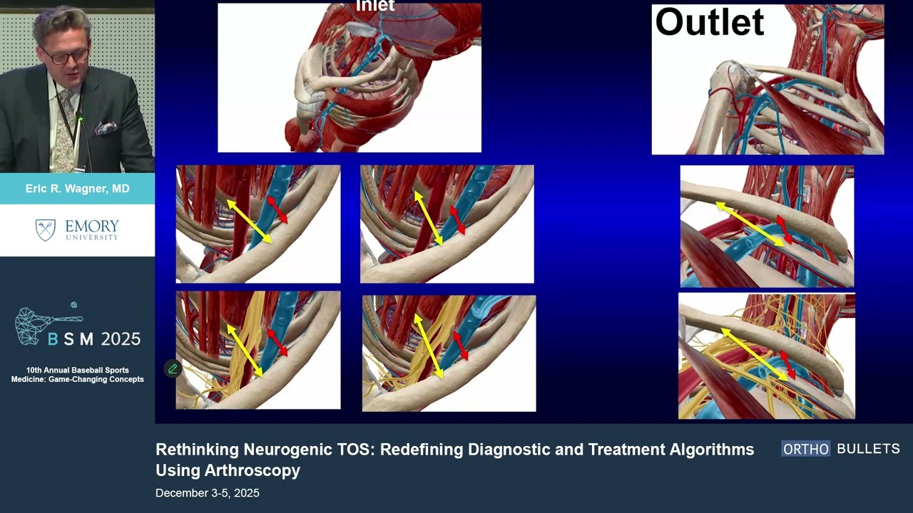Neurogenic TOS_Redefining Diagnostic & Treatment Algorithms Using Arthroscopy_Eric R. Wagner MD