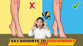 How To Get Rid Of Strawberry Legs in 1 Day | Strawberry Legs Home Remedies