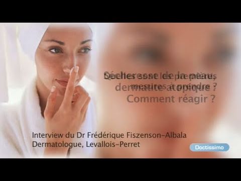 Cura di centro di eczema Creme di steroide e unguenti a eczema varicoso