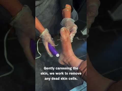 How to soften and prevent hard dry skin from feet |. How to treat dry feet