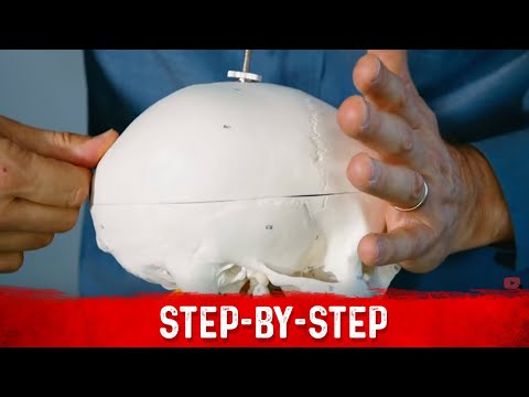 Sciatic Nerve Pain Be Gone Dr Berg s Quick Fix Solutions