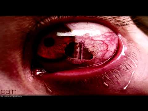 IGNEON SYSTEM - Hit The Hood