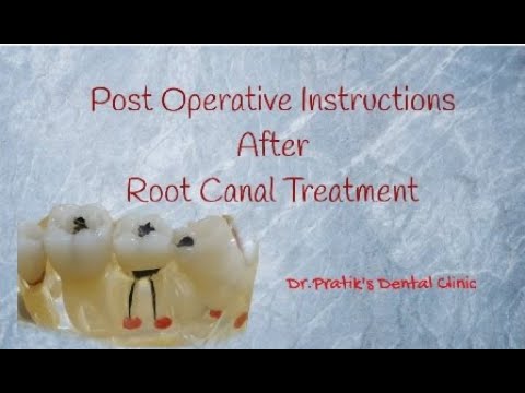 download lagu mp3 mp4 Root Canal Treatment Aftercare, download lagu Root Canal Treatment Aftercare gratis, unduh video klip Root Canal Treatment Aftercare