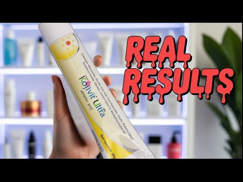 Hydroquinoine Kojic Acid gel, Normal Skin, Packaging Size: 15 gm