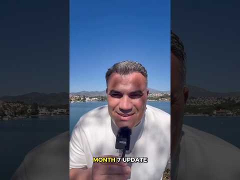 7 Months After My Hair Transplant #turchcare #hairtransplant