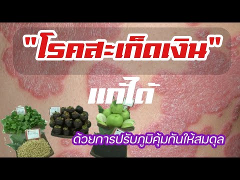 ผิวหนังกลากภูมิแพ้ มันเป็นไปได้ที่จะทำแต่งหน้าถาวรสำหรับโรคสะเก็ดเงิน
