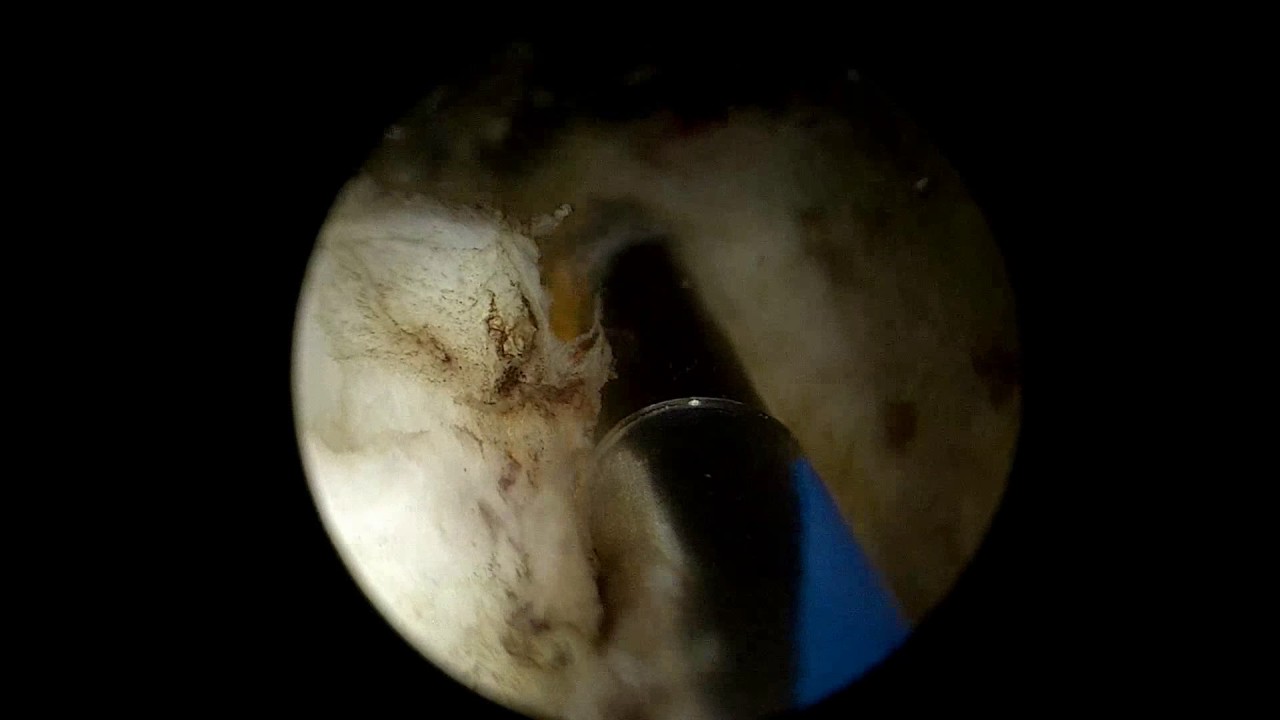 Mauricio Cantellano Orozco-25