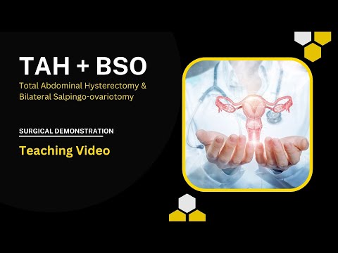 TAH + BSO | Hysterectomy | Bilateral Salpingo-ovaritomy | Teaching Video | Surgical Demo