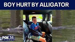 Boy attacked by alligator during Florida father-son fishing trip, family says