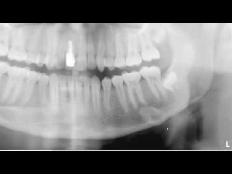 Test your panoramic anatomic landmark skill