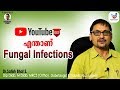 എന്താണ് Fungal Infections? |Dr.Satish Bhat S.|Diabetic Care | Malayalam Health Tips