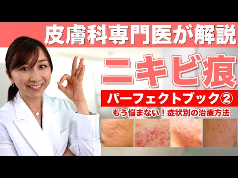 ニキビ跡を取り除く方法 – 軟膏と治療法