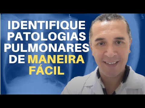 Raio X do Tórax  10 Patologias Mais Comuns
