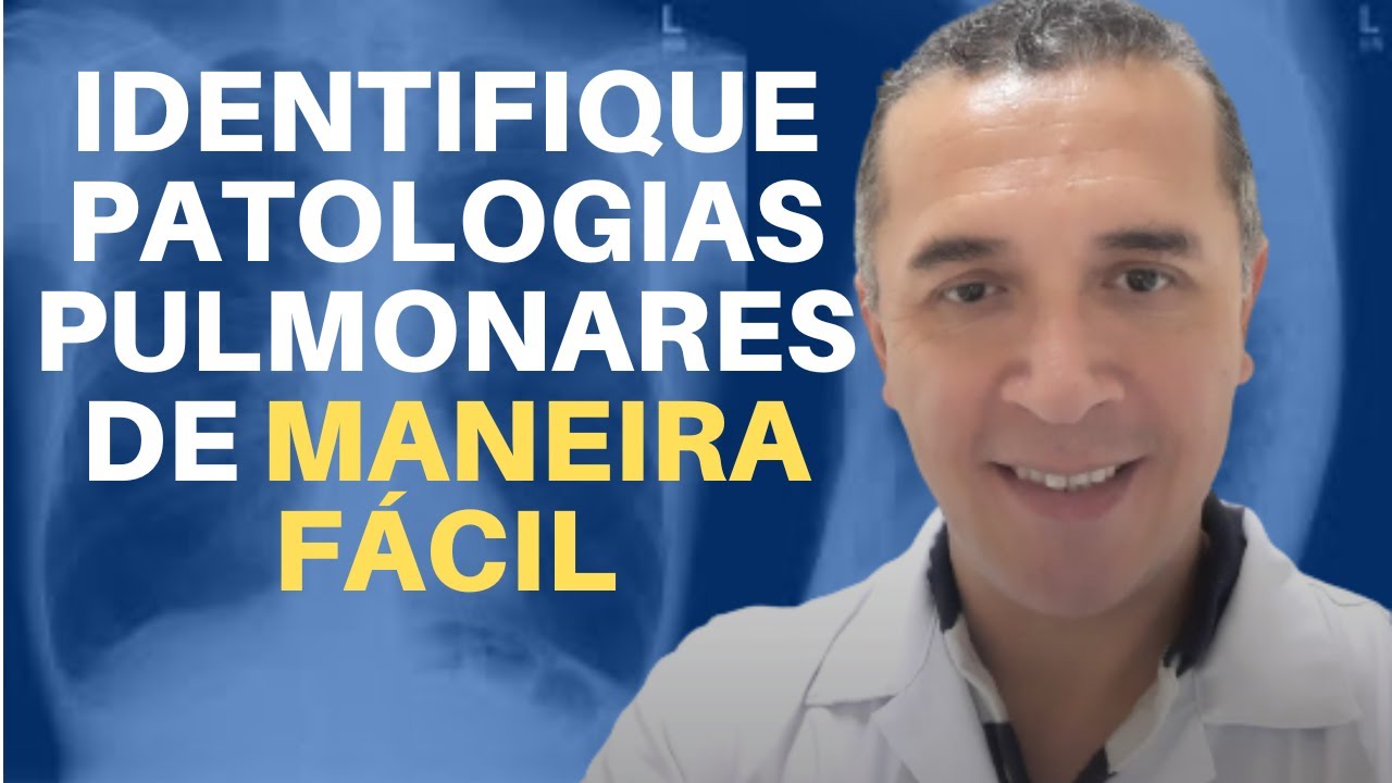 Raio X do Tórax  10 Patologias Mais Comuns