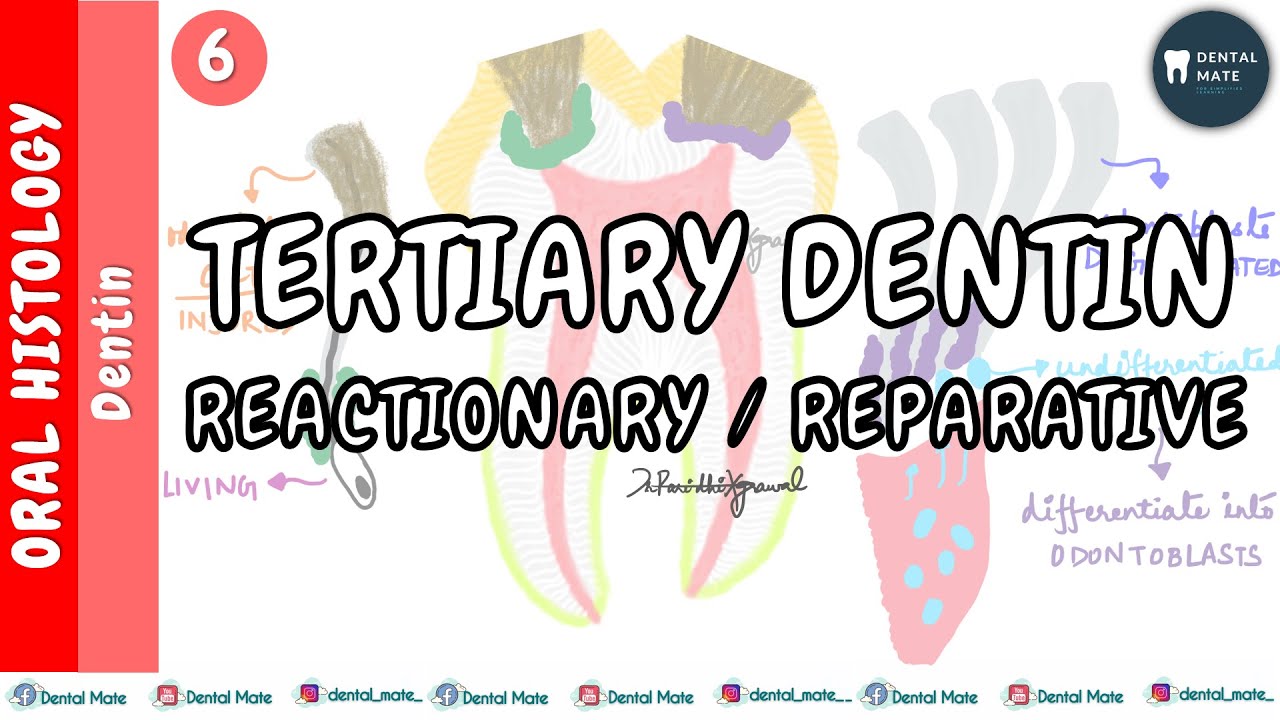 What is the difference between reparative and tertiary dentin? Tipseri