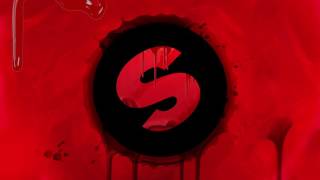Carnage x Timmy Trumpet - Psy Or Die (Spinnin Records) [EXCLUSIVE]