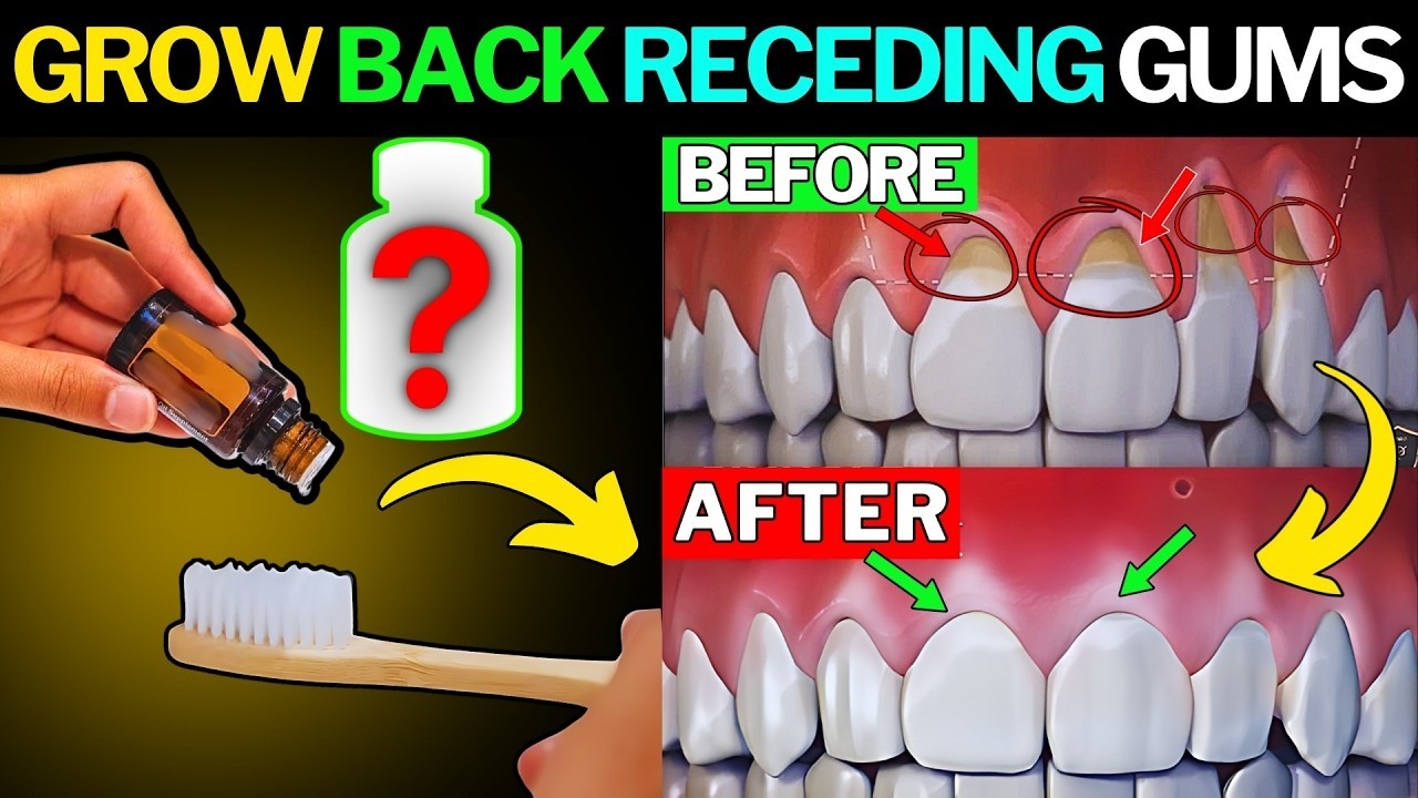 How to Regrow Receding Gums Fast Naturally