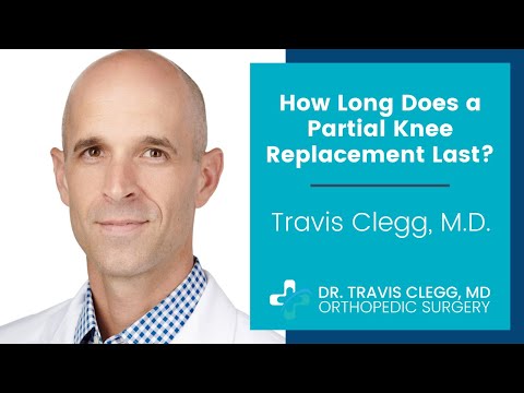 How Long Does a Partial Knee Replacement Last? | Travis Clegg, M.D.