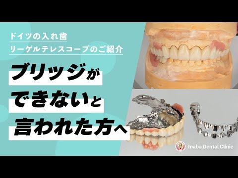ブリッジができないと言われた方へ〜リーゲルテレスコープのご紹介〜