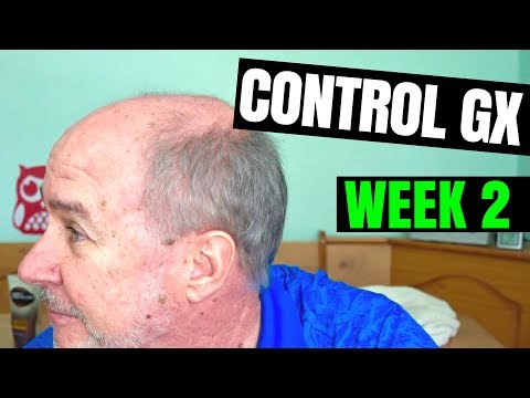 Control GX Review- Week 2 Follow Up