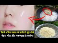 3 दिन चावल के पानी से मुँह धोए फिर देखे �
